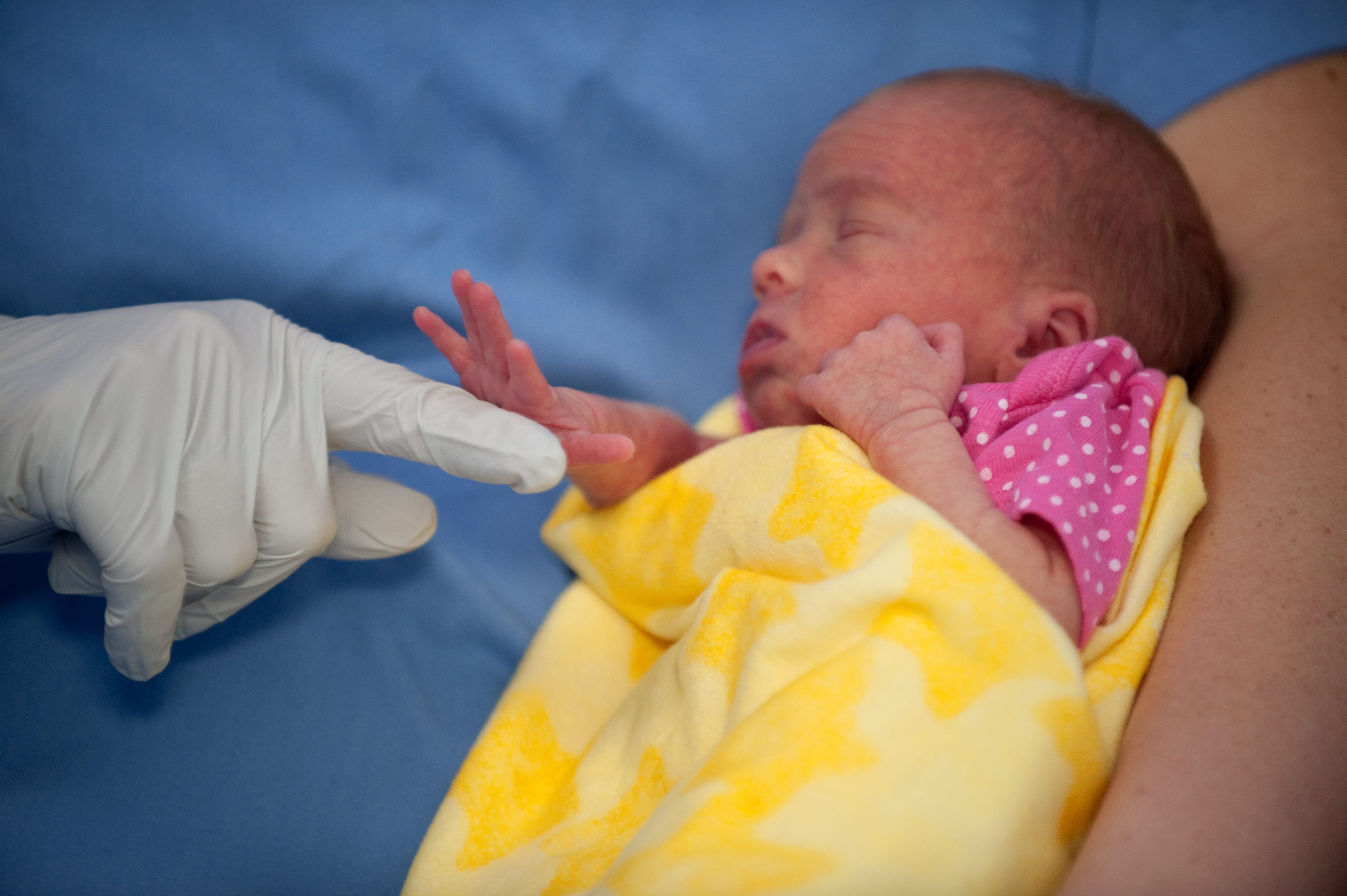 NICU patient baby Megan grabs onto the finger of glove wearing registered nurse