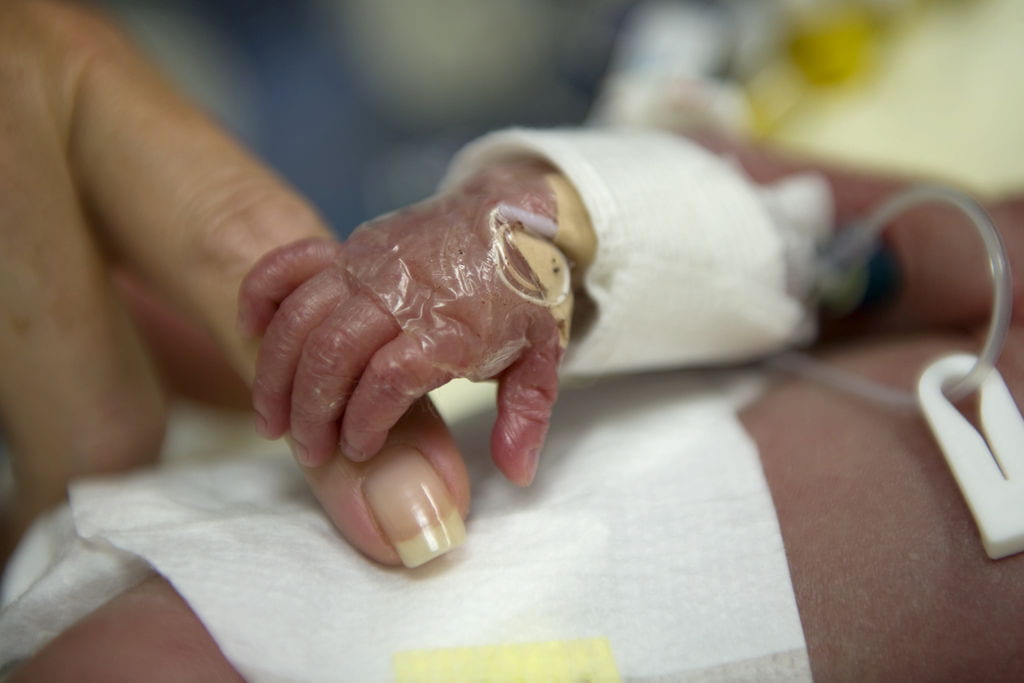 Infant in the NICU