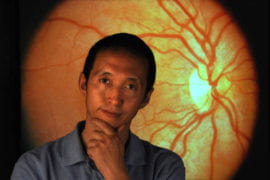 Alzheimer’s lesions found in the retina