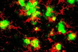 Blocking inflammation prevents cell death, improves memory in Alzheimer’s disease