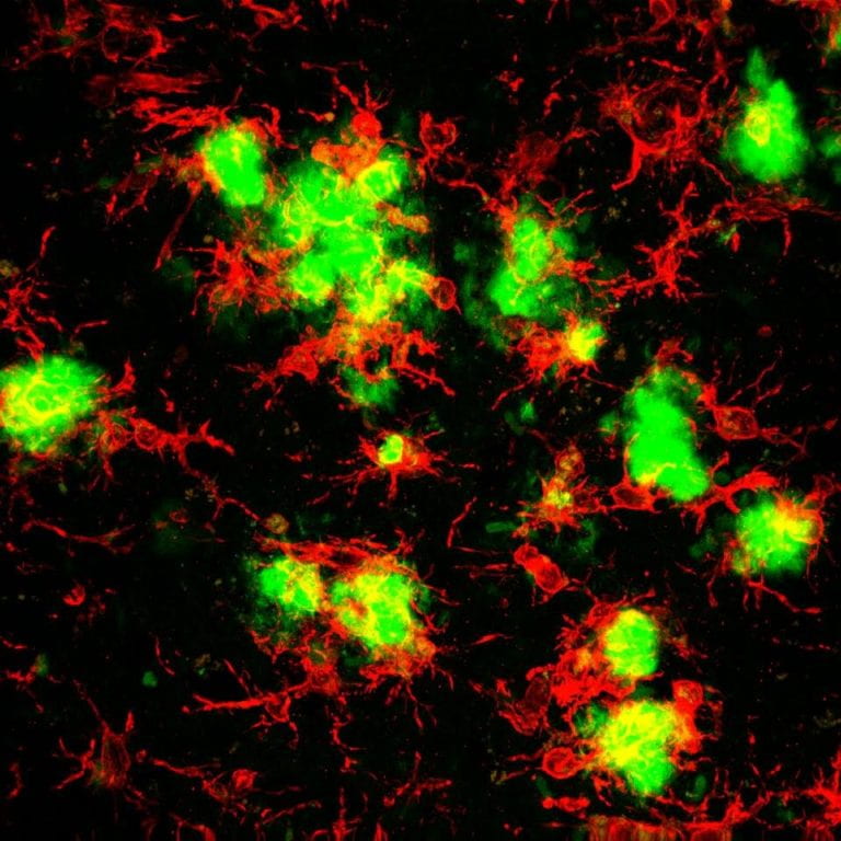 Blocking inflammation prevents cell death, improves memory in Alzheimer’s disease