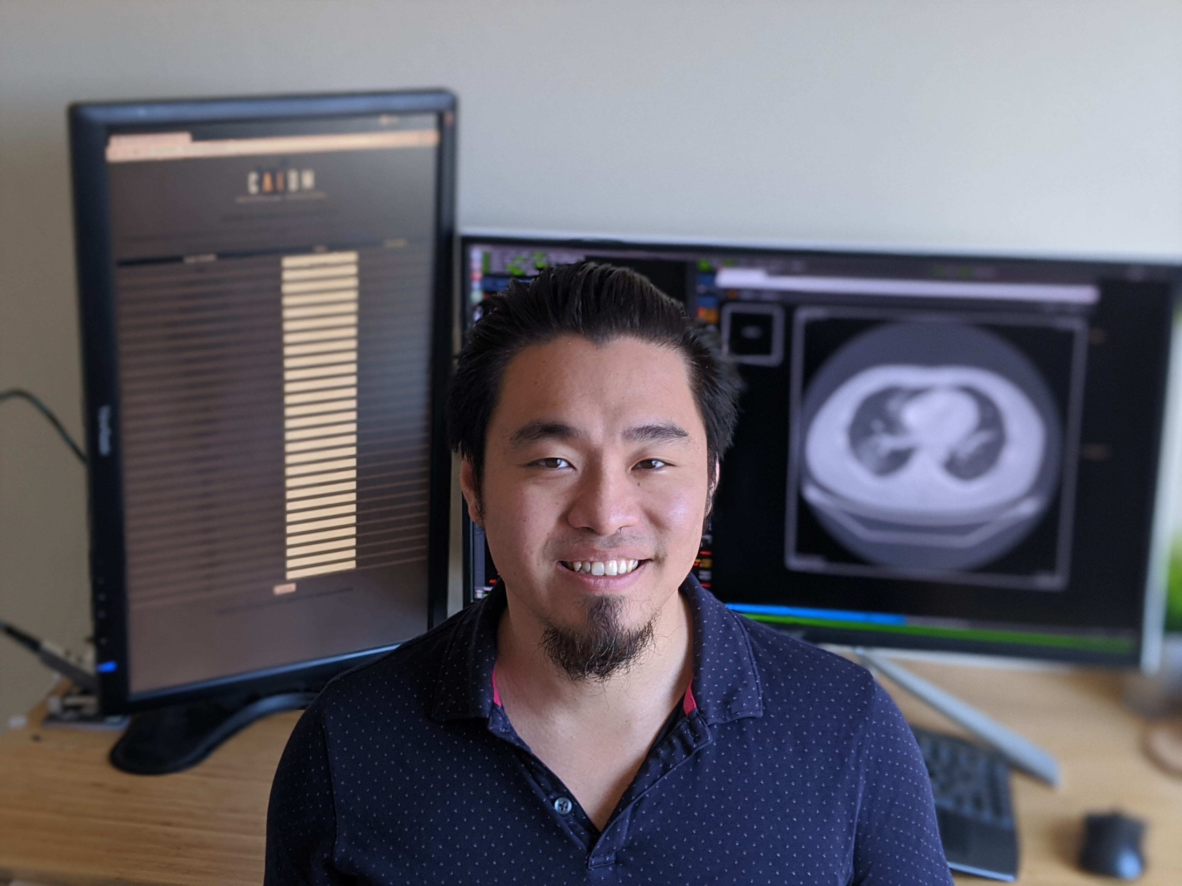 Dr. Peter Chang, a UCI Health neuroradiologist who designed the algorithm and is co-director of UCI’s Center for Artificial Intelligence in Diagnostic Medicine said "In the course of just a month or so, we’ve gotten the data, built the model, tested it on some cohorts and launched it on a website.”