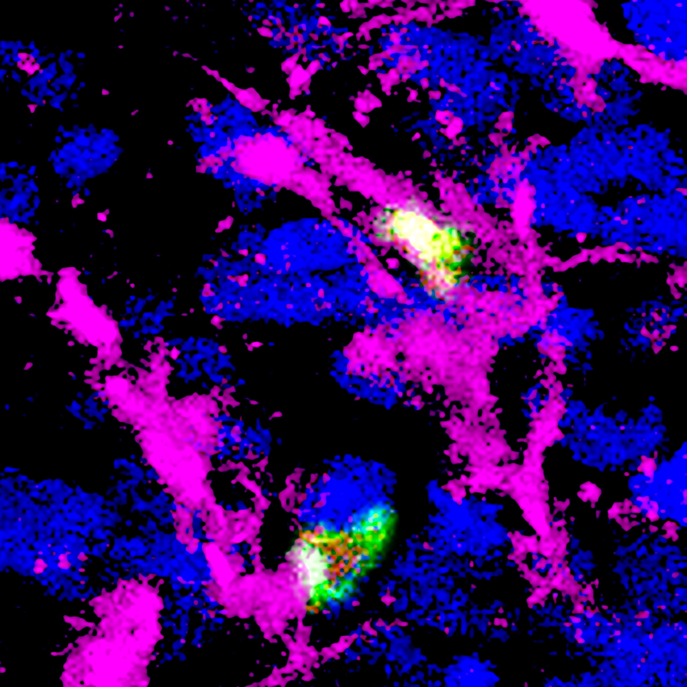 T regulatory cells (green with red nuclei) interact with antigen-presenting cells (magenta) in a tumor (blue). The Treg cell on top is activated (green fluorescence in the nucleus), while the one at the bottom is not (green fluorescence outside the nucleus). Activation of Treg cells promotes tumor growth.
