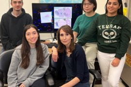 UCI researchers discover crucial role of brain’s striatum cilia in time perception