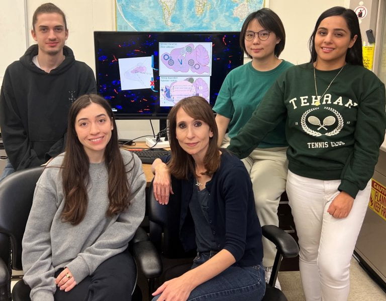 UCI researchers discover crucial role of brain’s striatum cilia in time perception