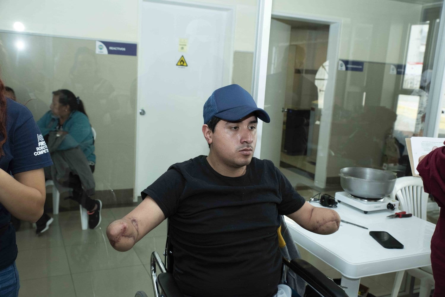 Jefferson Aguirre, whose arms and legs were amputated after he was electrocuted while cutting pipe.